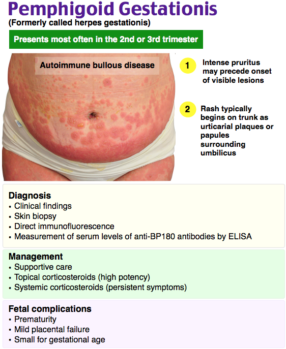 Pruritic Urticarial Papules And Plaques Of Pregnancy First Trimester